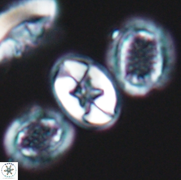 Eiffellithus gorkae 12182
