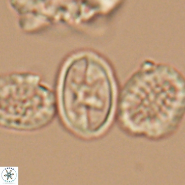 Eiffellithus gorkae 12190