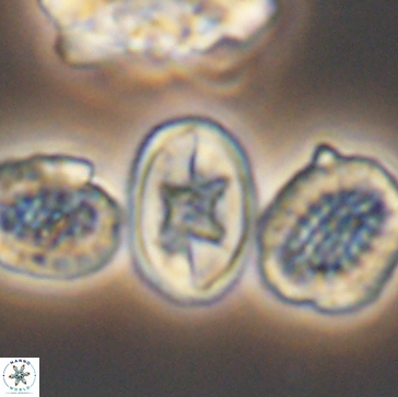 Eiffellithus gorkae 12191