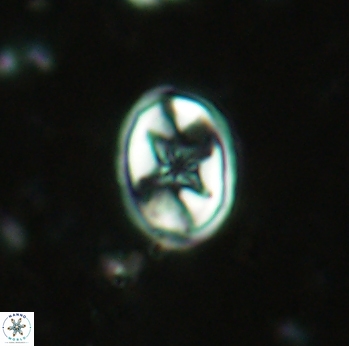 Eiffellithus gorkae 2294
