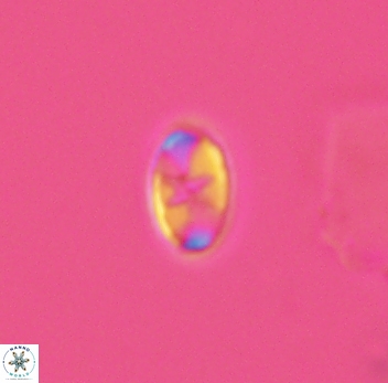 Eiffellithus gorkae 3938