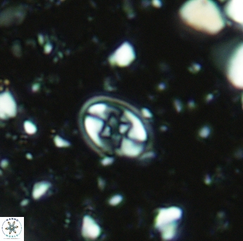 Eiffellithus gorkae 5177