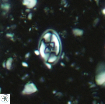 Eiffellithus gorkae 5179