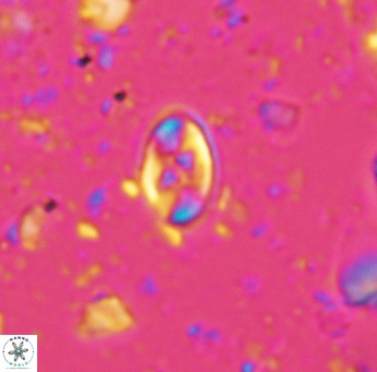 Eiffellithus gorkae 5180