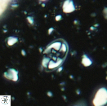 Eiffellithus gorkae 5181