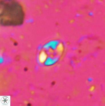 Eiffellithus gorkae 6052
