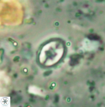 Eiffellithus gorkae 6053