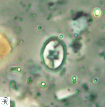 Eiffellithus gorkae 6054