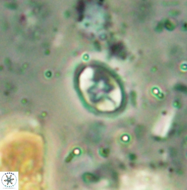 Eiffellithus gorkae 6055