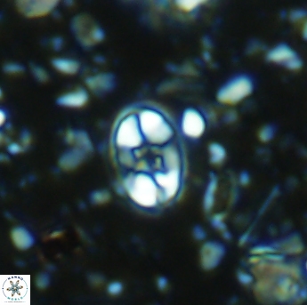 Eiffellithus gorkae 6273