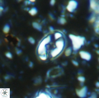 Eiffellithus gorkae 6277