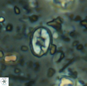 Eiffellithus gorkae 6279