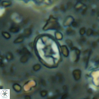 Eiffellithus gorkae 6280
