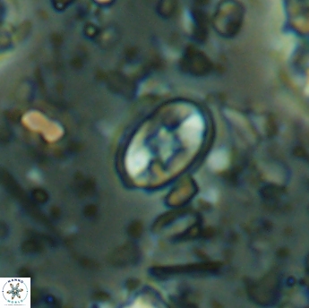 Eiffellithus gorkae 6281