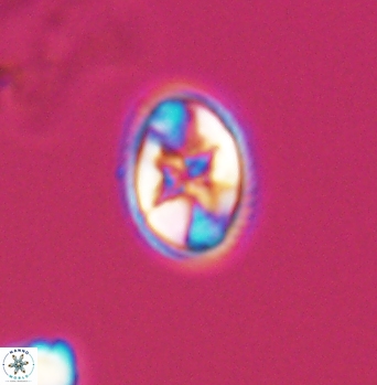 Eiffellithus gorkae 8300
