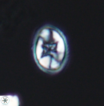 Eiffellithus gorkae 8301