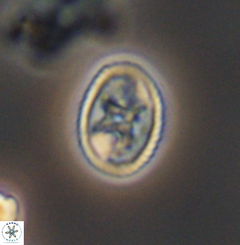 Eiffellithus gorkae 8304
