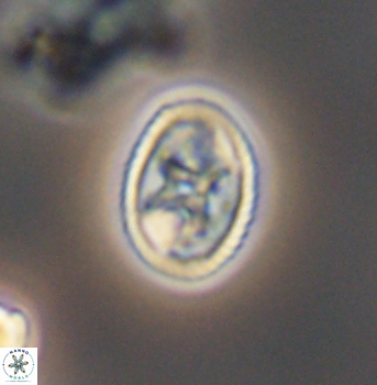 Eiffellithus gorkae 8305