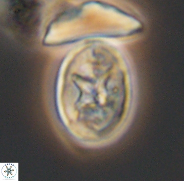 Eiffellithus gorkae 9918