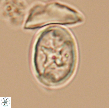 Eiffellithus gorkae 9919
