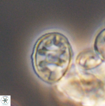 Eiffellithus equibiramus 8499