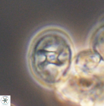 Eiffellithus equibiramus 8500