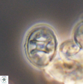 Eiffellithus equibiramus 8501