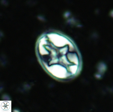Eiffellithus eximius 05460