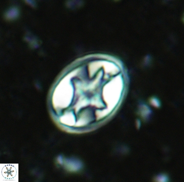 Eiffellithus eximius 05461