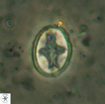 Eiffellithus eximius 05463