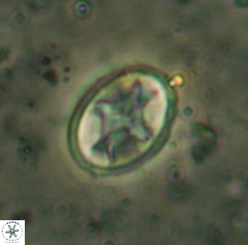 Eiffellithus eximius 05465