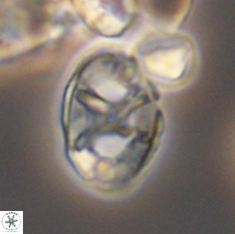 Eiffellithus keio 8727