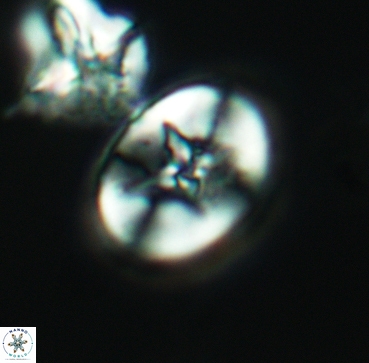 Eiffellithus leptacrostauros 03344