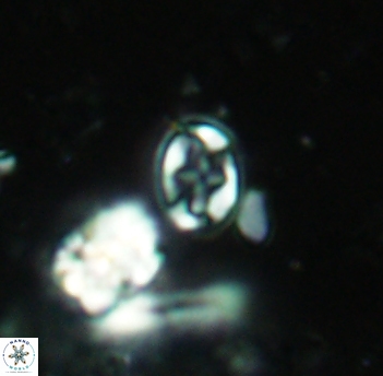 Eiffellithus lindiensis 4625