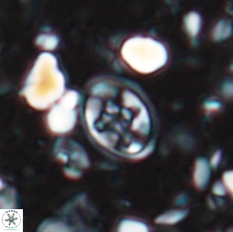 Eiffellithus monechiae 15404