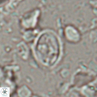 Eiffellithus monechiae 15408