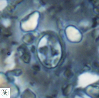 Eiffellithus monechiae 15409