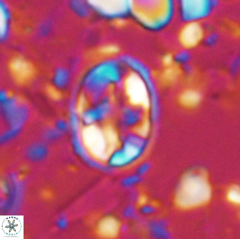 Eiffellithus monechiae 15415