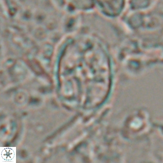 Eiffellithus monechiae 15418