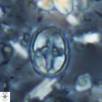 Eiffellithus monechiae 15419