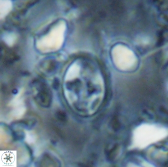 Eiffellithus monechiae 15410
