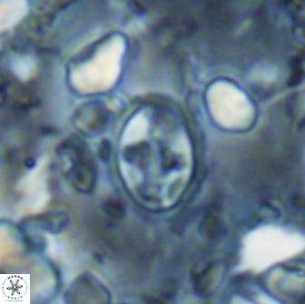 Eiffellithus monechiae 15411