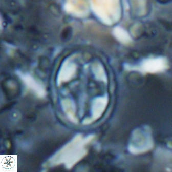 Eiffellithus monechiae 15420