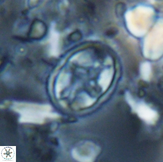 Eiffellithus monechiae 15421