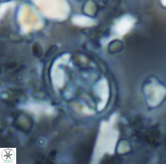 Eiffellithus monechiae 15422