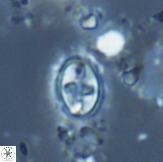 Eiffellithus monechiae 17004