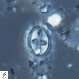 Eiffellithus monechiae 17005