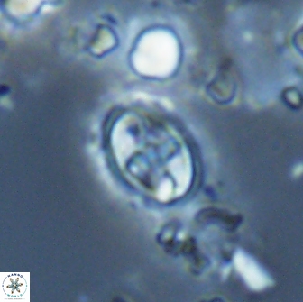 Eiffellithus monechiae 17007