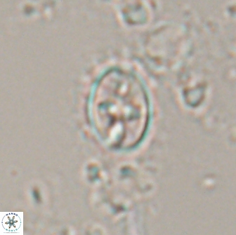 Eiffellithus monechiae 17002