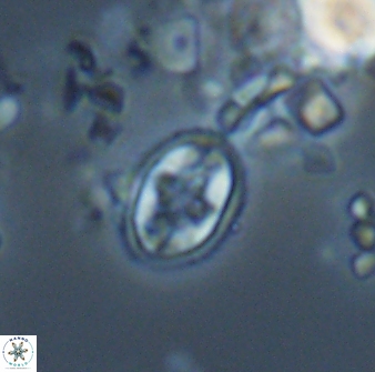 Eiffellithus monechiae 17424